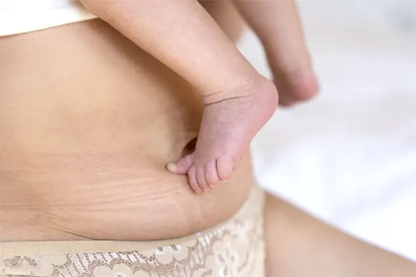 img-cuanto-tarda-en-sanar-un-desgarro-de-parto